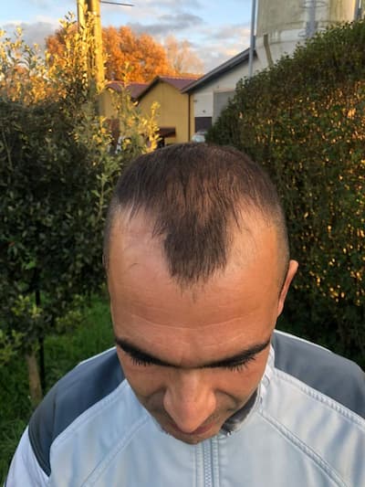 foto1