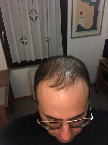 foto2